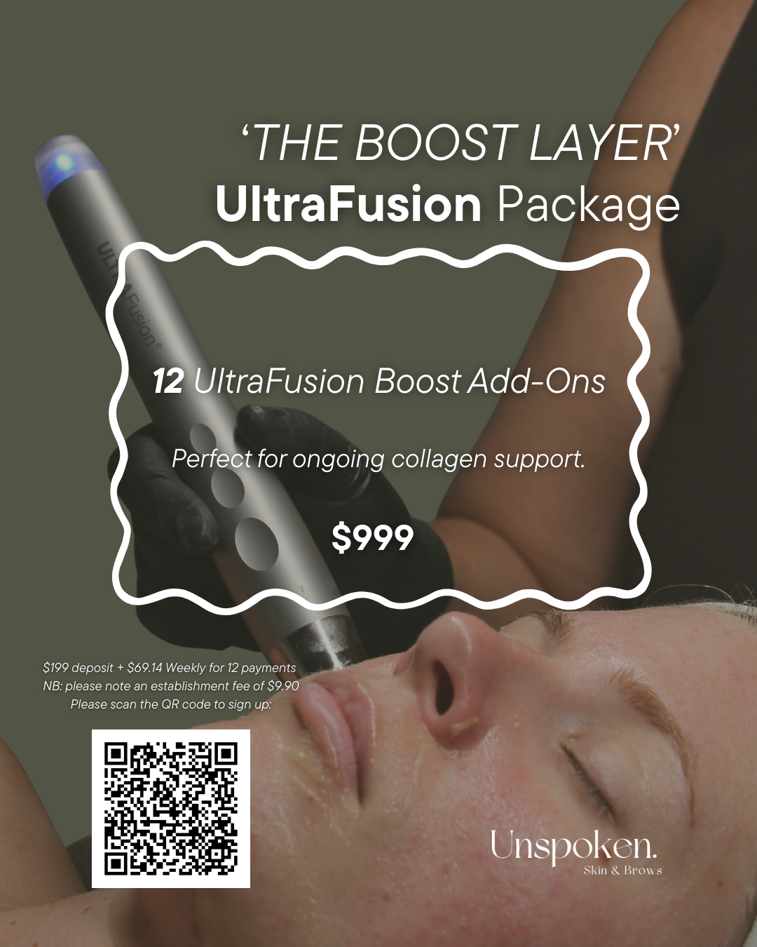 The Boost Layer - UltraFusion Package